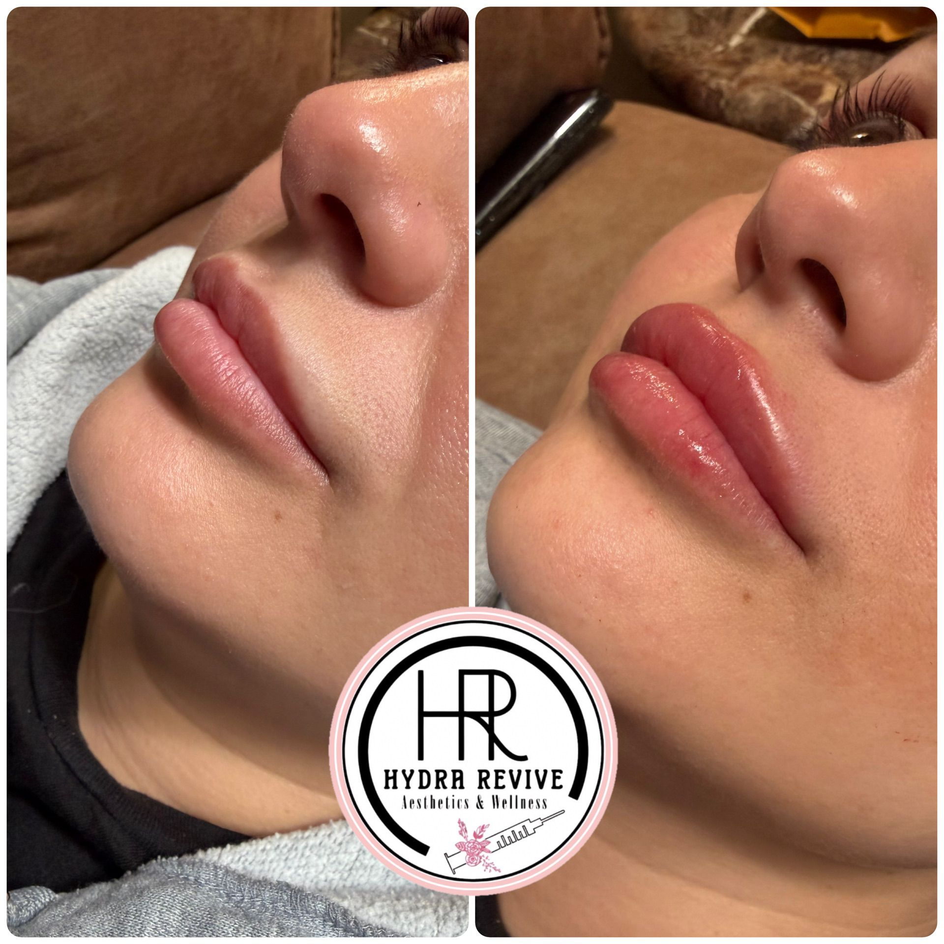 Soft hydration & gentle definition